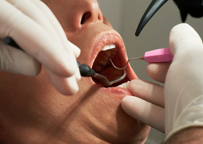 En silencio, Marruecos se está convirtiendo en una potencia económica peculiar: la «Turquía» de los dientes